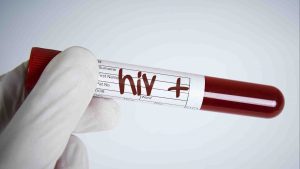 Pessoas com HIV estão fazendo mais a quarentena